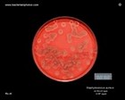 staphylococcus aureus on blood agar